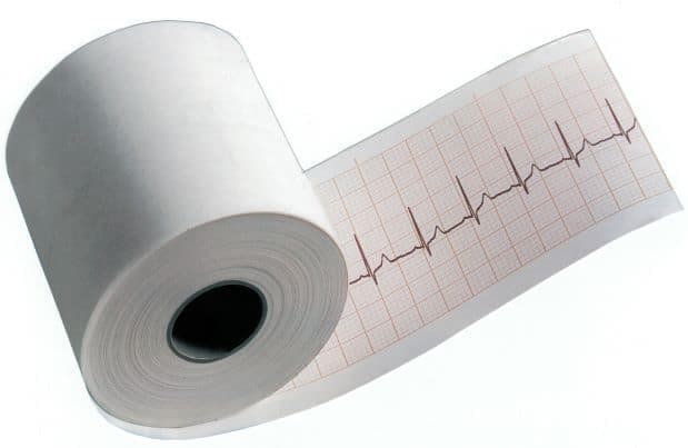 Rolo ecg